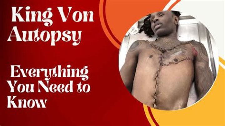 Latest Findings: King Von Autopsy Results Revealed
