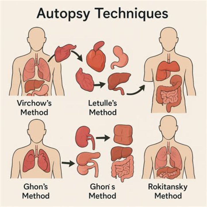 The Ultimate Guide To Different Types Of Autopsies: A Comprehensive Explanation